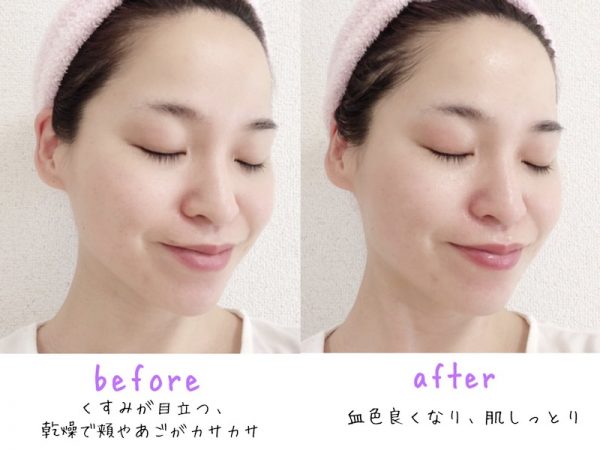 スキンケアビフォーアフター