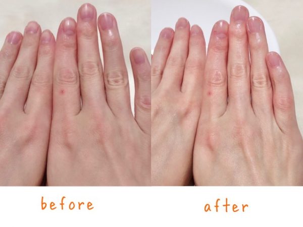 ハンドケア before after