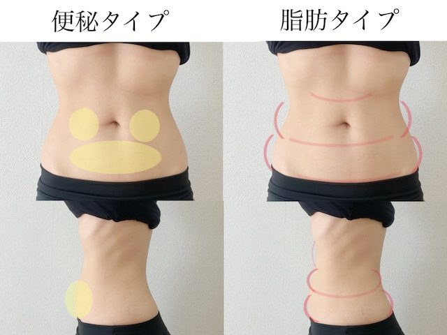 お腹
