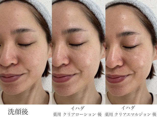 イハダ使用感