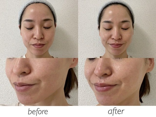 乳液、クリームで肌を整える