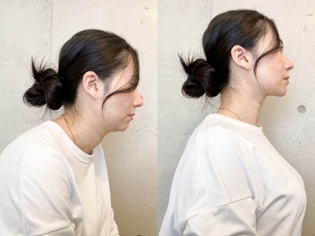 永松さん