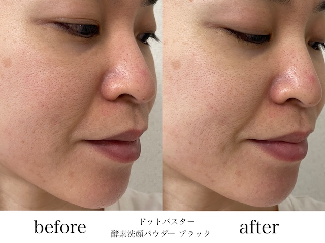 洗顔ビフォーアフター