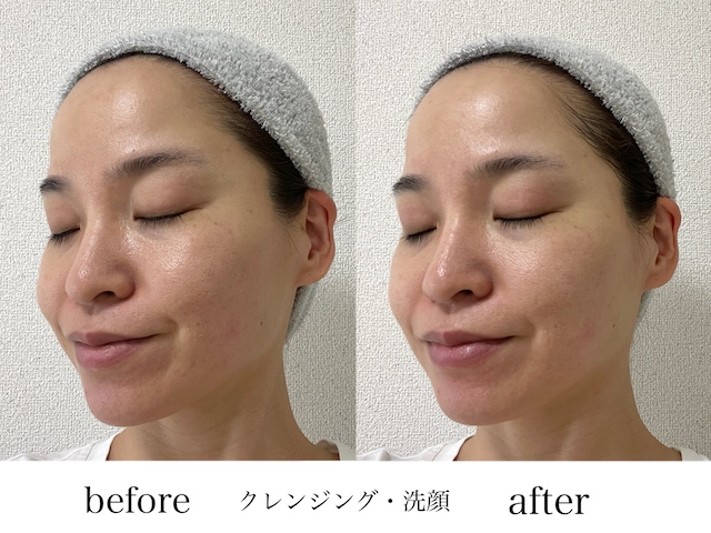 ビフォーアフター