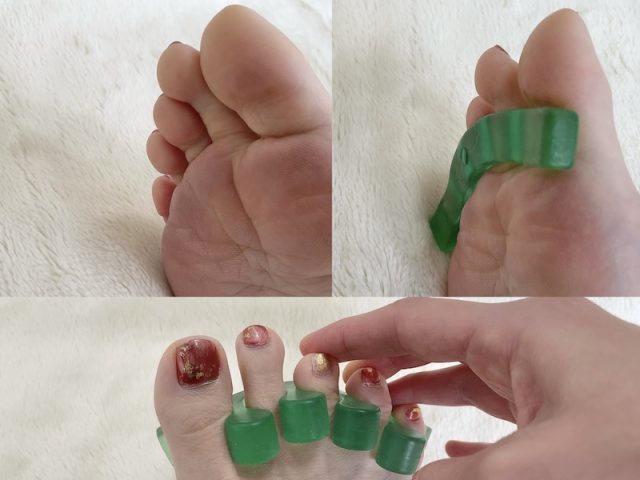 足指セパレータ