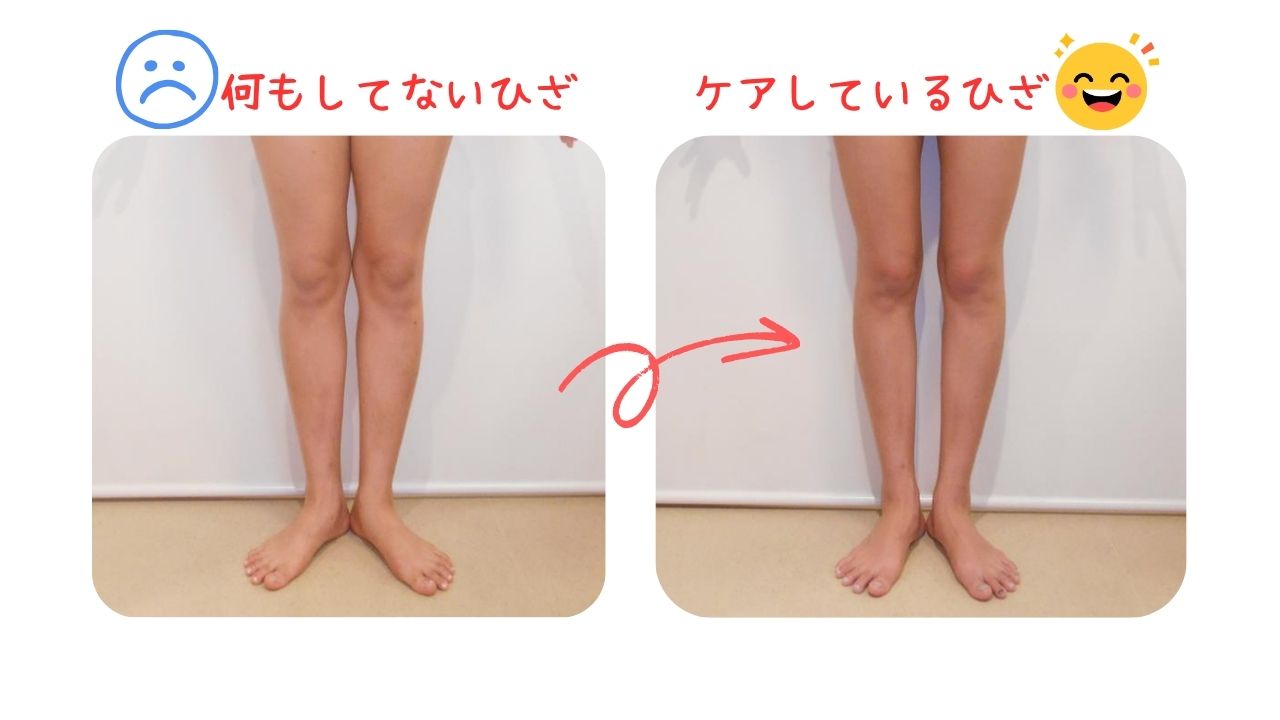 膝の比較