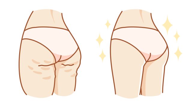 下半身の印象変化をイメージしたイラスト