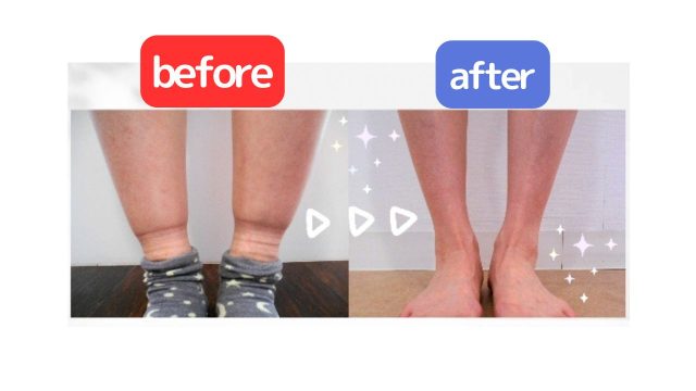Before→After